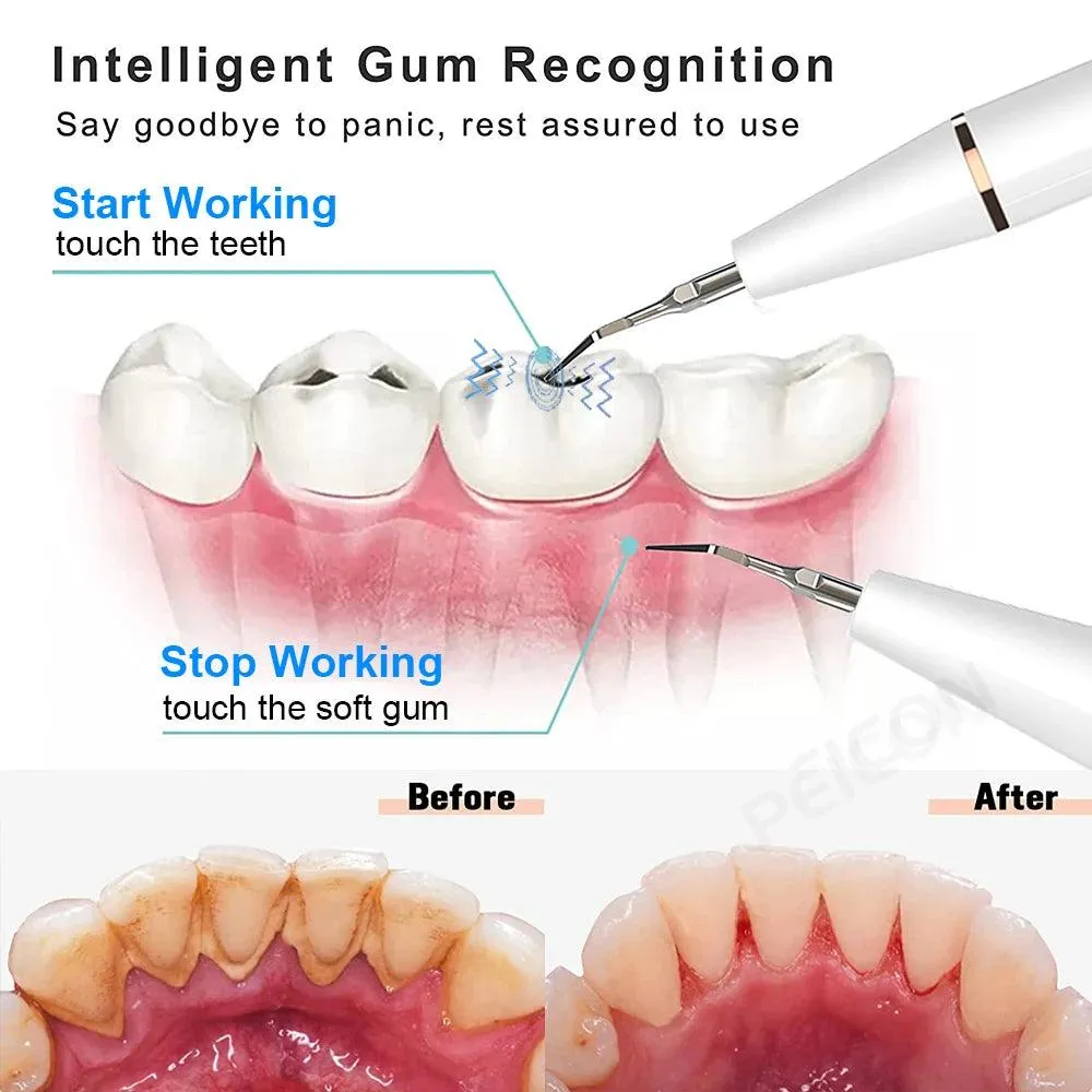 Peicon©- Home Use Dental Tools